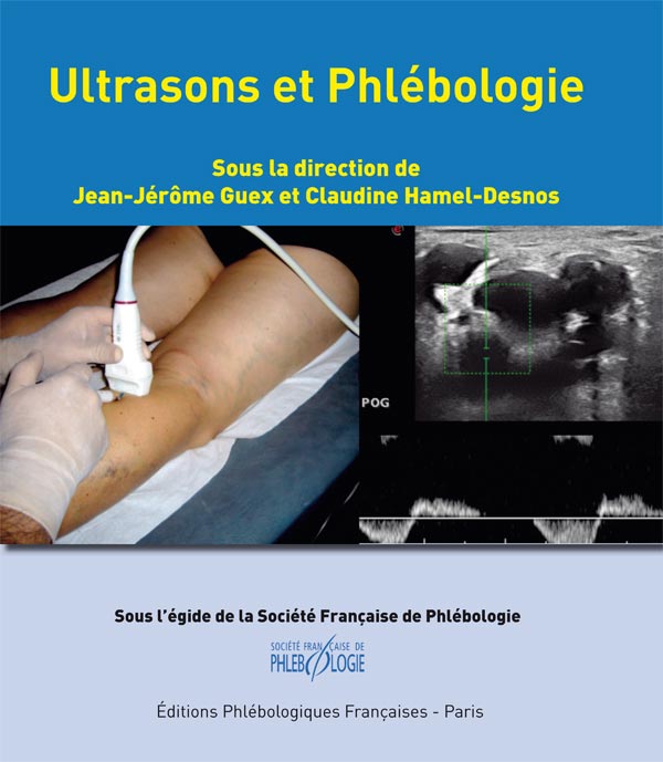 Ultrasons et Phlébologie